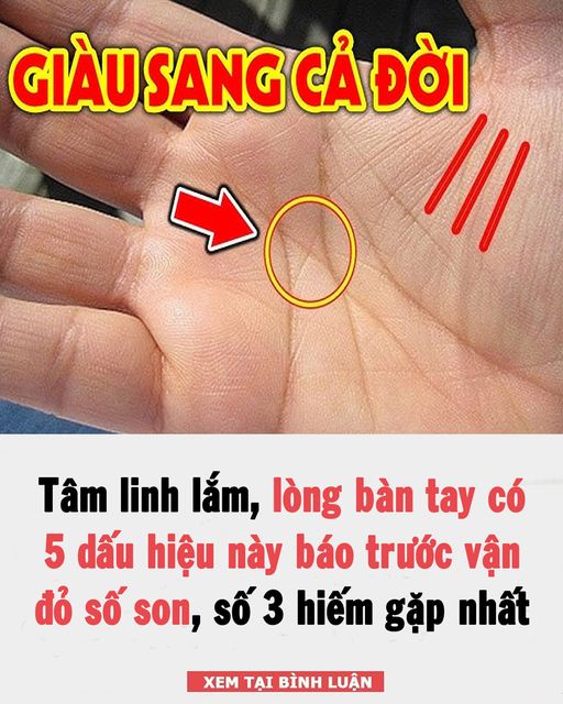 Lòng bàn tay có 5 dấu hiệu này báo trước vận đỏ số son, số 3 hiếm gặp nhất