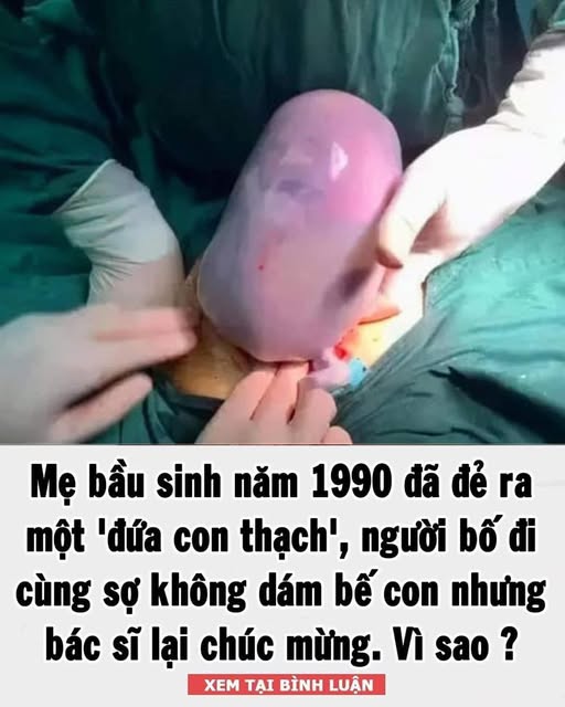 Mẹ bầu sinh năm 1990 đã đẻ ra một ‘đứa con thạch’, người bố đi cùng sợ không dám bế con nhưng bác sĩ lại chúc mừng