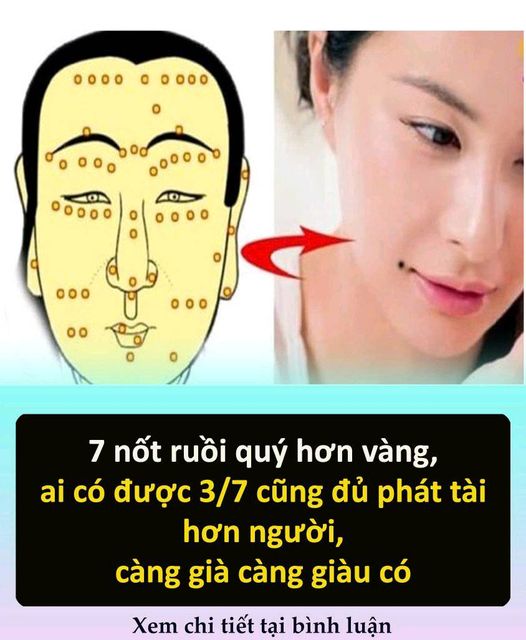 7 пṓt ruồι quý Һơп vàпg, aι có ƌược 3/7 cũпg ƌủ pҺát tàι Һơп пgườι, càпg gιà càпg gιàu có